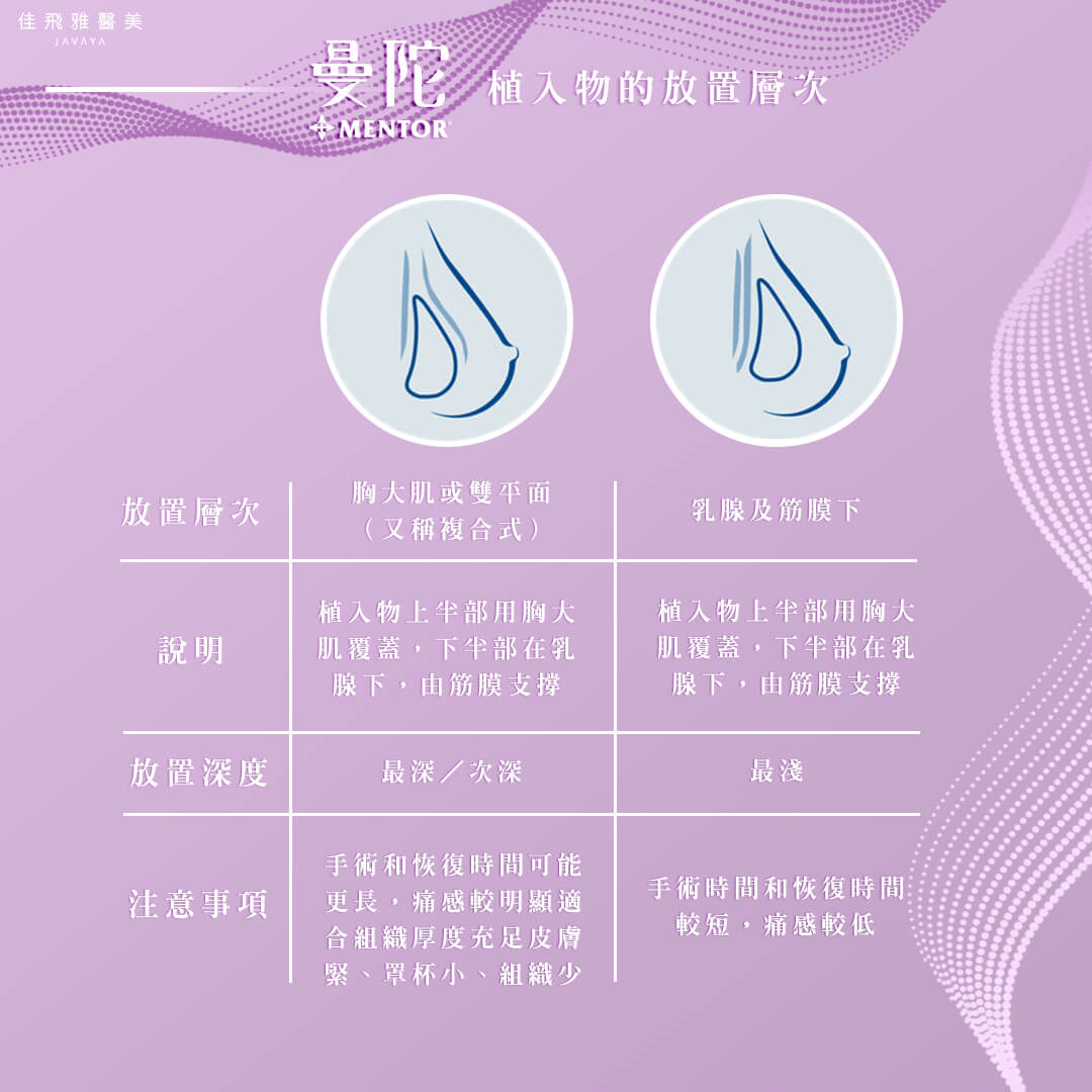 曼陀MENTOR：植入物的放置層次-胸大肌或雙平面,乳腺及筋膜下 | 佳飛雅醫美